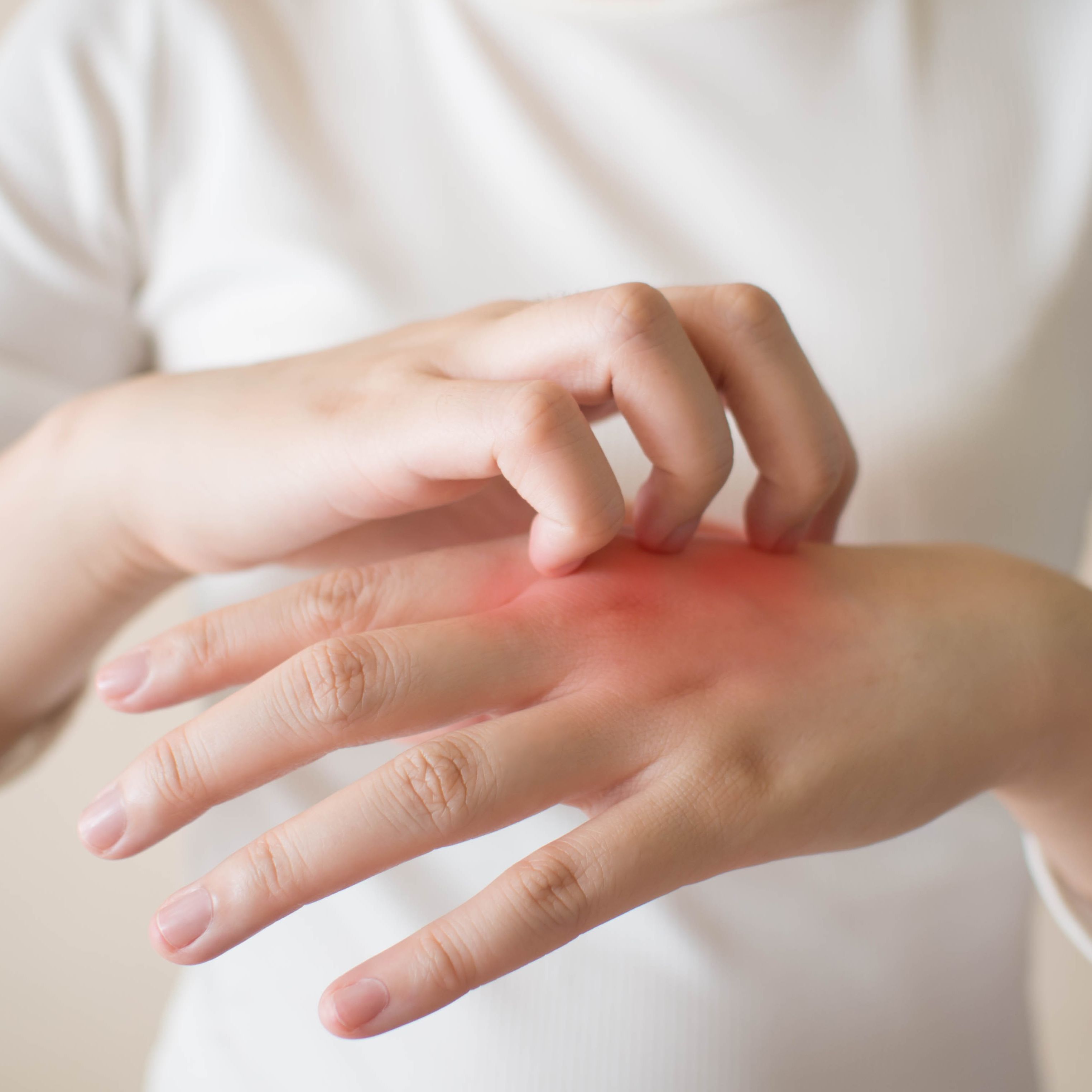 Allergy Dubai Doctor